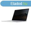 Kensington K55522WW 15" Surfacebook betekintsvd moni
