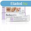 Redupetin dermatolgiai specilis kencs 20 ml