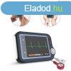 Home monitor Wellue - EKG monitor otthoni hasznlatra