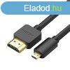 UGREEN HD127 Micro HDMI - HDMI 4K 3D kbel 1,5 m (fekete)