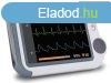 Home EKG Checkme?- EKG otthoni monitor