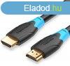 Vention HDMI, (fekete), 1m, kbel