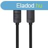 DisplayPort 1.2 Cable Vention HACBH 2m, 4K 60Hz (Black)