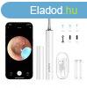 Smart Visual Ear-Clean Rod Bebird T15 fehr