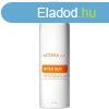 Sun napozs utni testpol spray - doTERRA