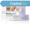 Redupetin dermatolgiai specilis kencs 20 ml