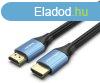Vention HDMI/M -> HDMI/M (4K, HD, Alu, kék), 1,5m, kábel